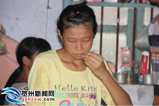 亲朋<em>众志</em>成城 为救10岁烧伤<em>男童</em>齐尽力 - 贺州